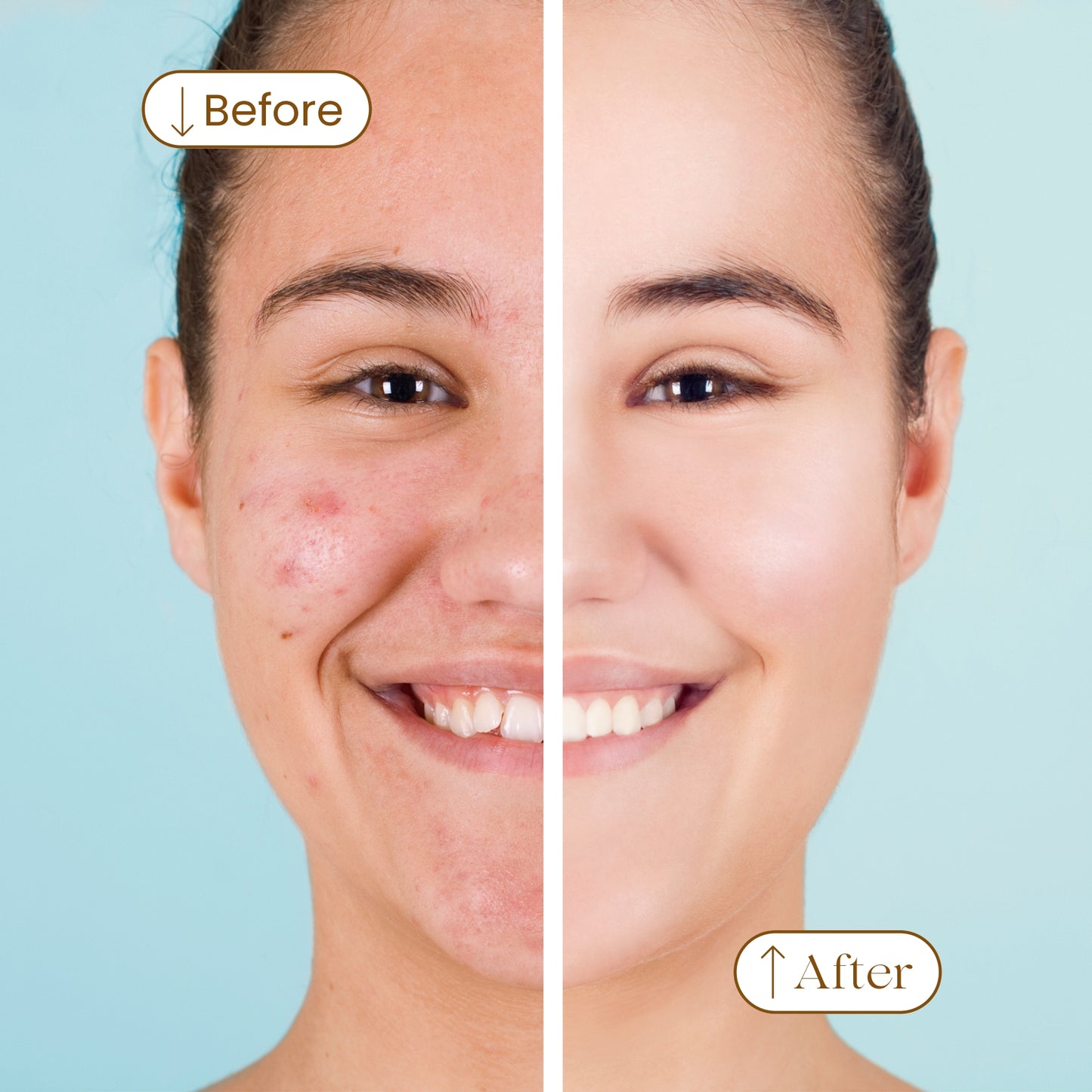 Oil Control Face Wash - For Acne & Oily Skin